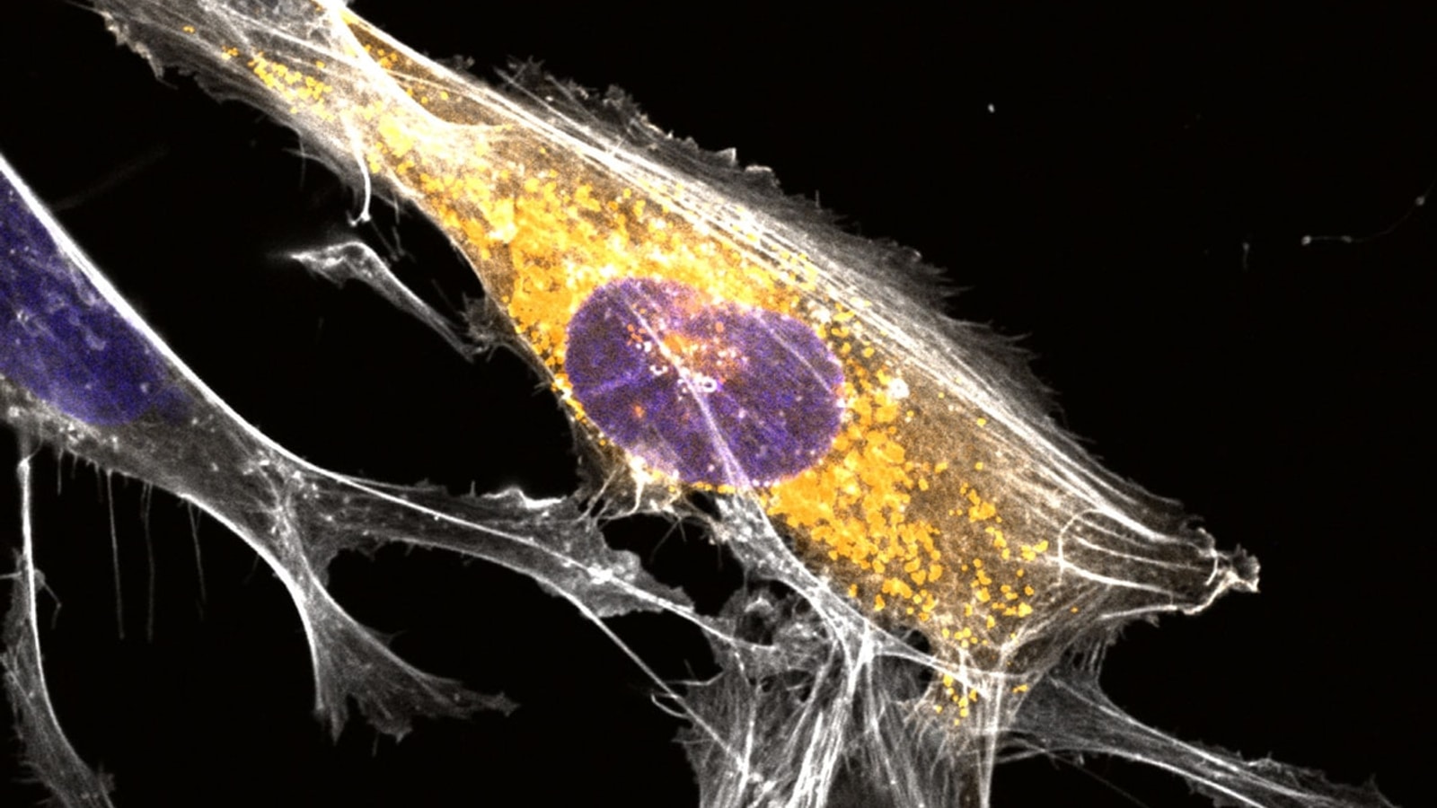 Microglial cell with an uncharacterized microprotein concentrated around its nucleus